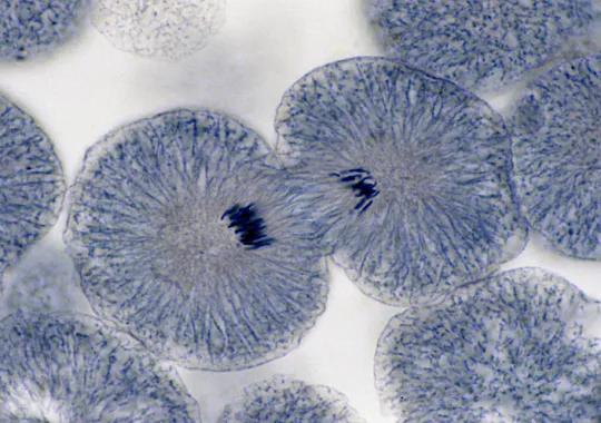 Cancer,Cancer drug